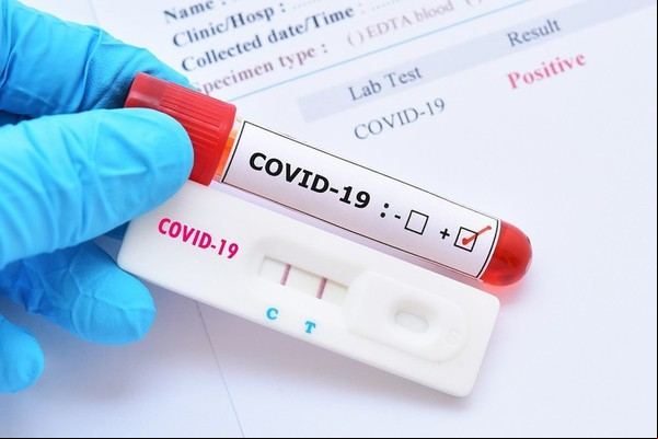 Comitê vê estabilização dos números da Covid-19 e boletim a a ser semanal