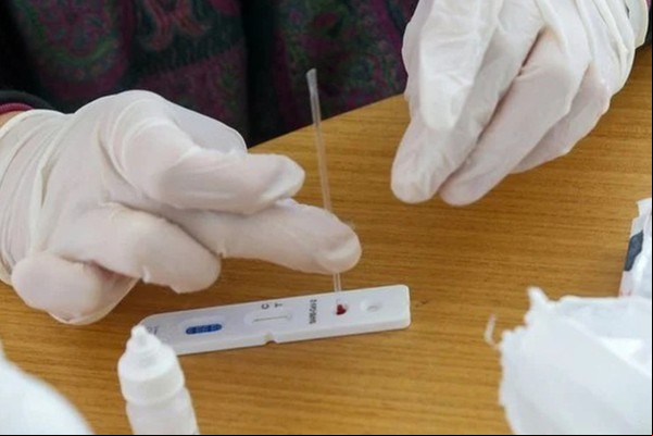 Patos de Minas confirma mais 493 casos de Covid-19, mas casos ativos diminuem
