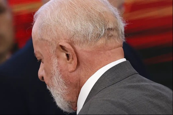 Lula vai a hospital e retira pontos de corte após queda