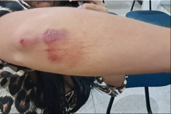Comerciante é preso por arrastar esposa no asfalto após discussão por ciúmes em Patos de Minas