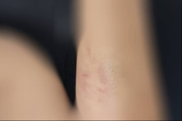 Grávida de 6 meses foge de casa após agressões do companheiro em Patos de Minas