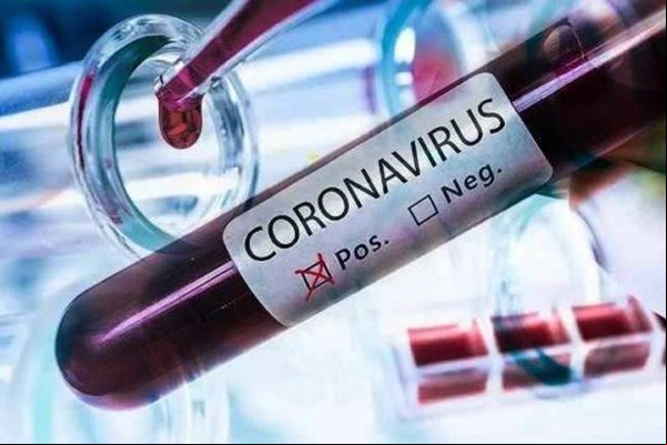 Em boletim antecipado, Prefeitura confirma mais 61 casos de Covid-19 em Patos de Minas